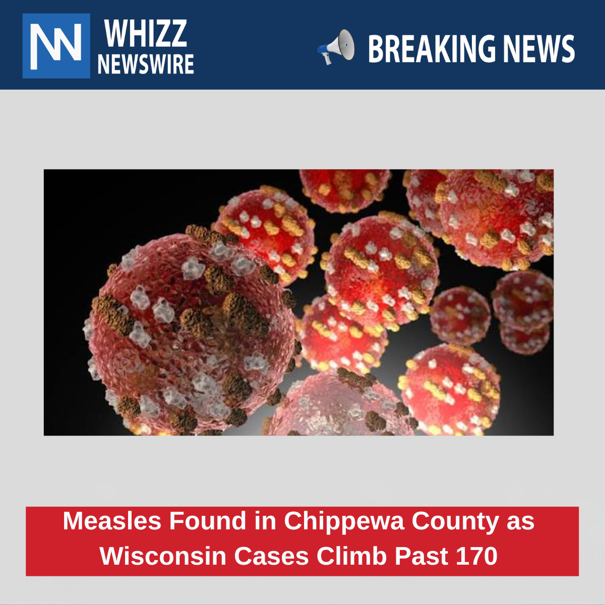 Measles Found in Chippewa County as Wisconsin Cases Climb Past 170